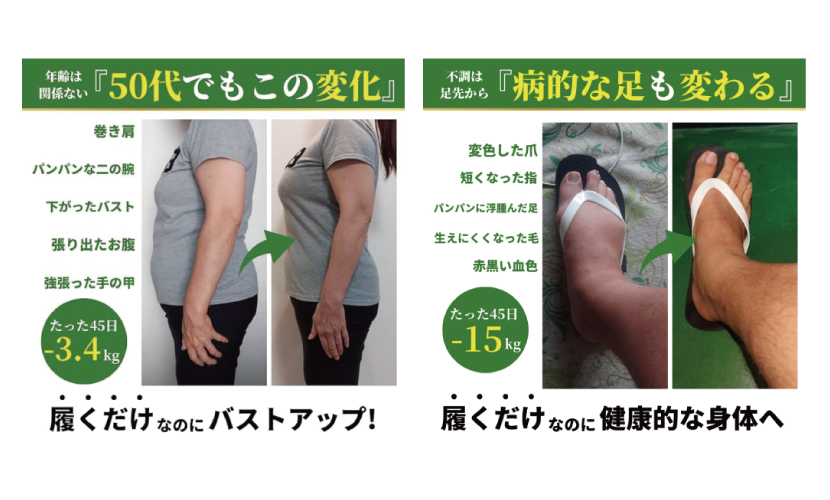 ラクバキ -5kgサンダルのメカニズム。履いて痩せるダイエットサポートシューズならラクバキ -5kgサンダル。